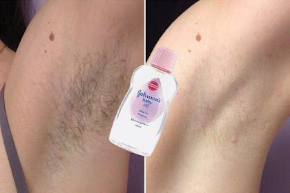 Remove Unwanted Hair Permanently In 3 Days! No Shave No Wax