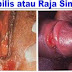 Resep Obat Raja Singa