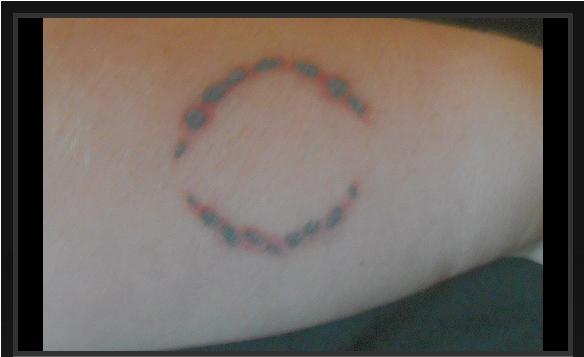 This Bite Mark is in reference to the one Bella gets from James in Twilight