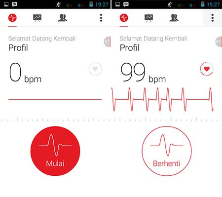 Cardiograph