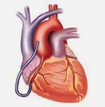 7 Cara Untuk Kesehatan Jantung