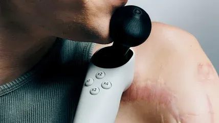 Controle acessível Xbox , Acessibilidade em jogos , Microsoft , Xbox Adaptive Joystick,  Xbox