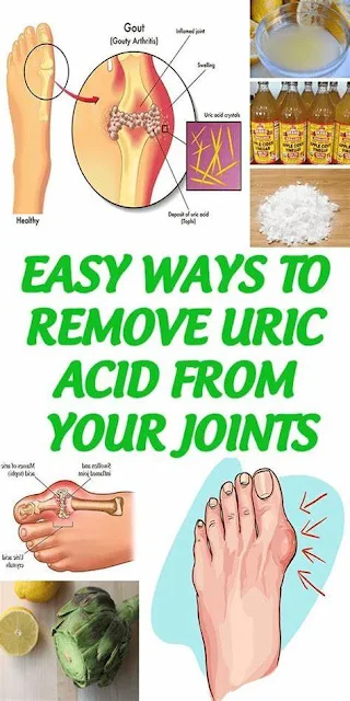 Easy Ways To Remove Uric Acid From Your Joints