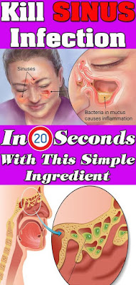 KILL SINUS INFECTION IN 20 SECONDS WITH THIS SIMPLE METHOD AND THIS COMMON HOUSEHOLD INGREDIENT!