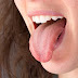 मुँह के छालों के लिए घरेलू उपचार - Home Remedies for Mouth Ulcers (Muh ke Chale) in Hindi