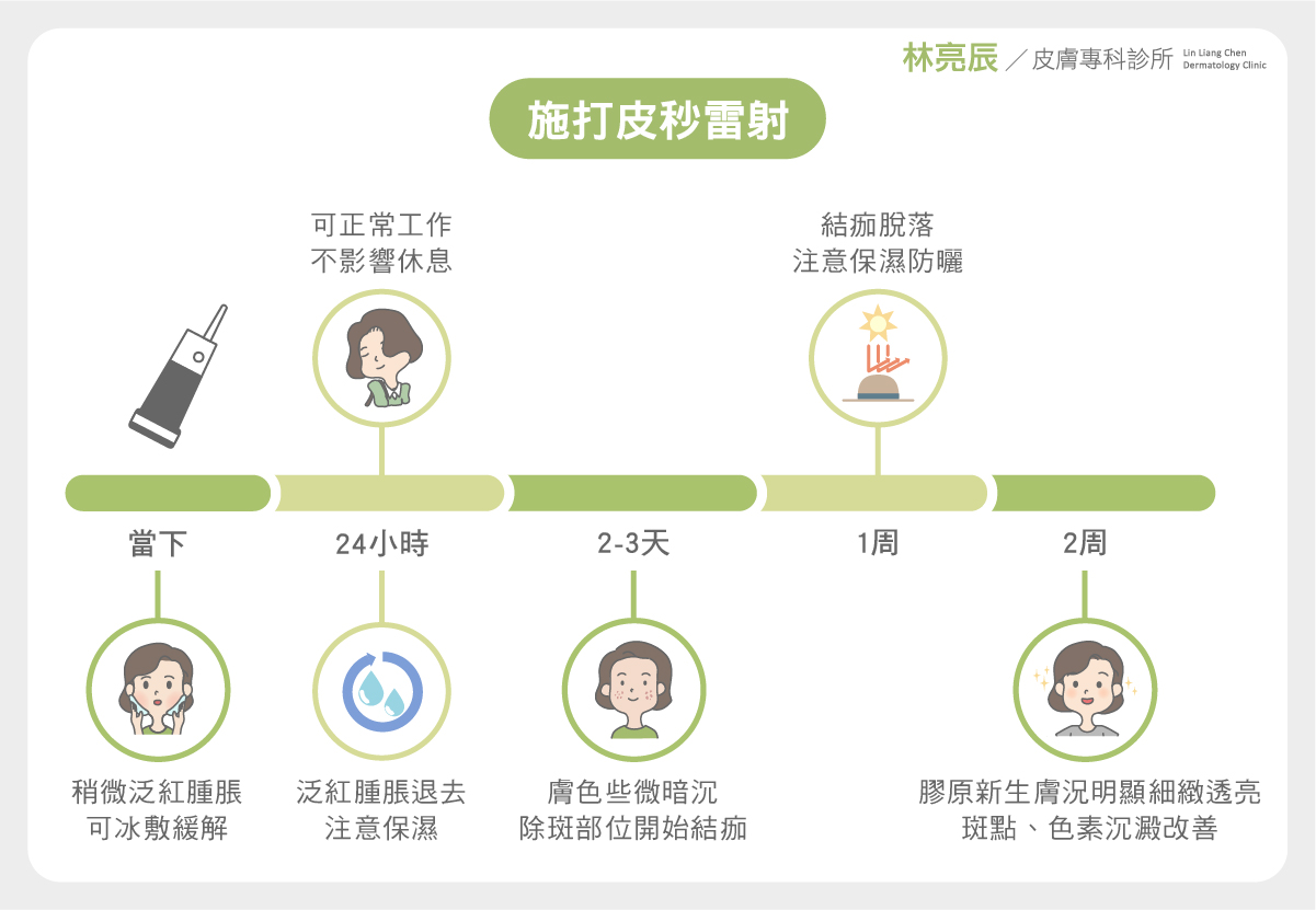 施打完PicoSure 755蜂巢皮秒雷射術後的恢復歷程