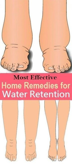 Reduce Water Retention With This Natural Remedy