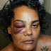 Mulher acusa policiais militares de agressão com golpes de madeira na frente dos filhos