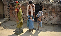 Baby with four legs in the abdomen