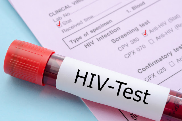 HIV AIDS: Human Test Of HIV Vaccine Delivers Promising Result