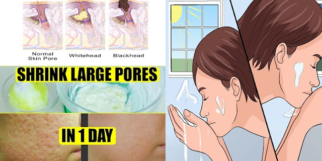 How To Get Rid Of Large Pores In 1 Day