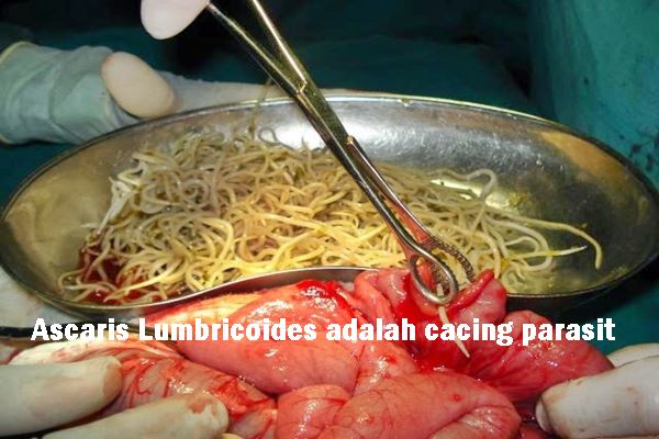 WASPADAI Ascaris Lumbricoides GANPOST