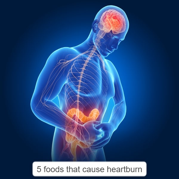 foods that cause heartburn