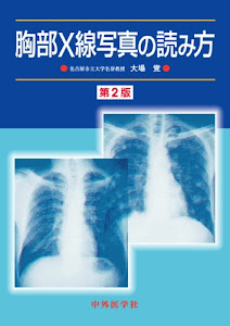 胸部X線写真の読み方