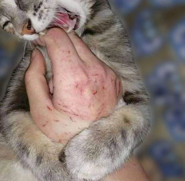 Man used hand as a cat toy. Bad idea.