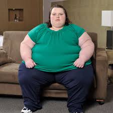 WHAT IS OBESITY/ AND OVERWEIGHT? TYPES OF OBESITY, CAUSES, SYMPTOMS, CHILHOOD OBESITY, DIAGNOSIS, TREATMENT