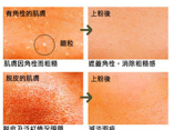 ettusaiscompactbeforeafter.1Q5MDv3KWQXb.jpg