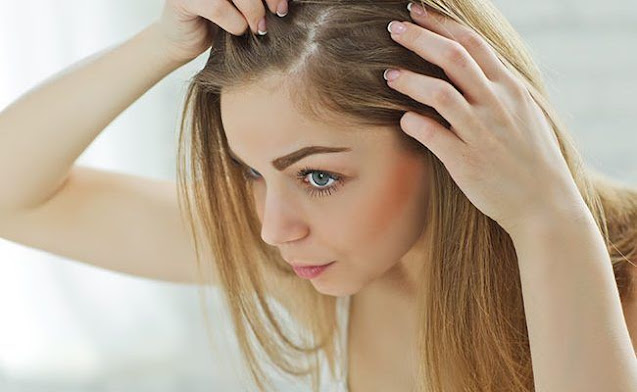 10 Amazing Tips to Prevent Hair Loss in Women