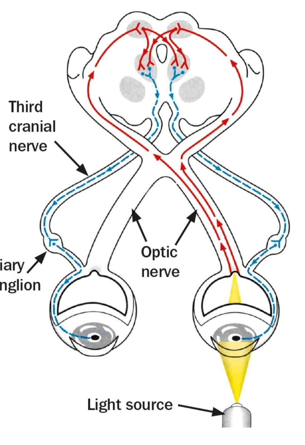 The swinging light test for relative afferent pupillary defect (RAPD)