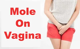 Mole On Vagina | Birthmark On Vagina | Astrology Meaning Of Mole On Female Private Parts
