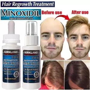 Hair Growth Essence Spray Anti Hair Loss Treatment Essential Oil Preventing Baldness Consolidating Nourish Roots Hair US $1 1 sold Free Shipping