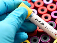 Syphilis is rising around the world.