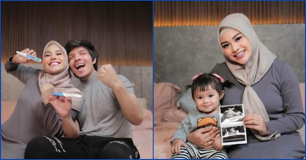 Resmi Umumkan Hamil Anak Kedua, Aurel Hermansyah Ngaku Syok!