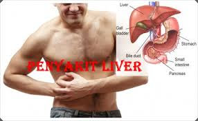 Obat Pilihan Herbal Ampuh Untuk Penyakit Liver Membengkak