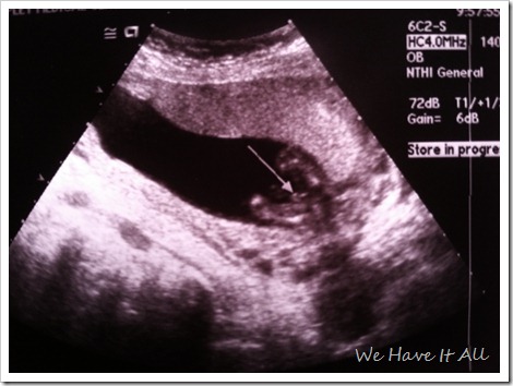 Can You Find Out Sex Of Baby At 8 Weeks : Dog Names For Chihuahua