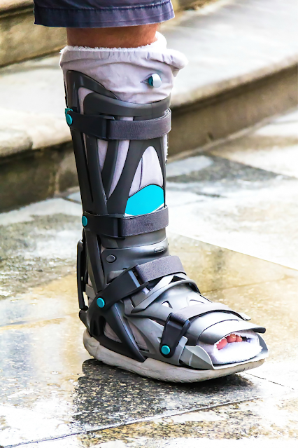 Ankle Braces in Rehabilitation