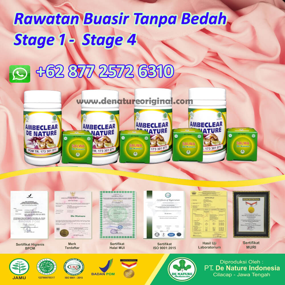 Ubat buasir tahap 4 de nature