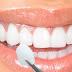 Có nên tiến hành chụp răng sứ thẩm mỹ hay không?