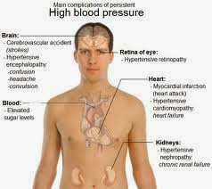 causes for low blood pressure, low blood pressure causes, low blood pressure symptoms, low blood pressure treatment, signs of low blood pressure, symptoms low blood pressure, symptoms of low blood pressure, what is low blood pressure, 