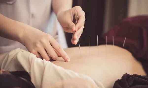 A Quick-Start guide to Acupuncture