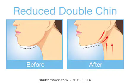 How To Lose Neck Fat