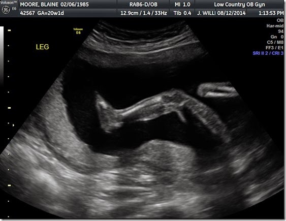 BLAINE 20 WKS_4