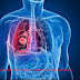 Understand and recognize symptoms of Mesothelioma