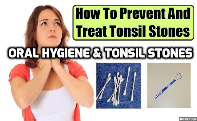 Individuals who do not maintain healthy oral hygiene routines are especially prone to developing tonsil stones, as the build-up of debris in the mouth can clog the surface of the tonsils. 