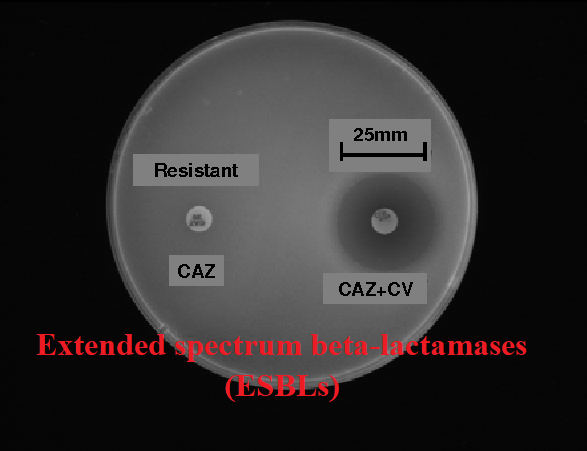 PHENOTYPIC DETECTION OF EXTENDED SPECTRUM BETA LACTAMASES PRODUCING ORGANISM 