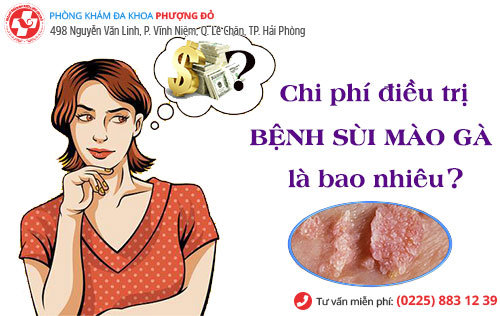 chi phí chữa sùi mào gà bao nhiêu