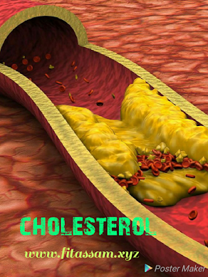 কলেষ্টৰেল সঁচাকৈয়ে বেয়ানে?  কলেষ্টৰেল কিমান হলে হাৰ্টৰ বাবে সংকতজনক? -cholestorel high,cholesterol level, cholesterol symptoms,cholesterol control in assamese
