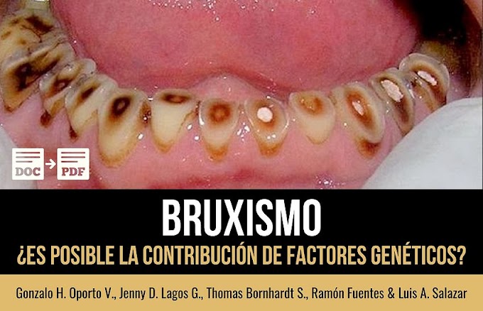 PDF: ¿Es posible la contribución de factores genéticos en el Bruxismo? 