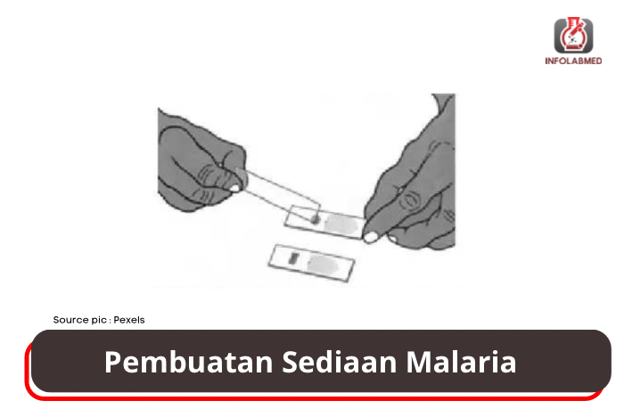 Pembuatan Sediaan Malaria