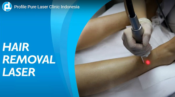 Pure Laser Clinic Hair Removal Laser