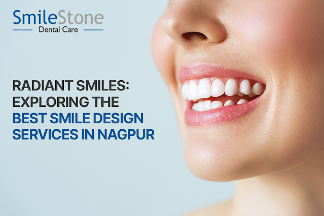 Best Smile Design in Nagpur