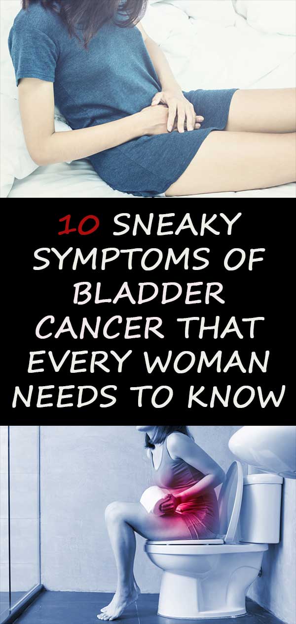 10 Sneaky Symptoms Of Bladder Cancer That Every Woman Needs To Know