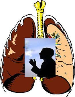 lung-cancer-ayurveda-cure