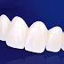 Tại sao có thể bọc răng sứ cho răng hô?