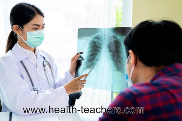 What are Tuberculosis? Tuberculosis or TB - Health-Teachers
