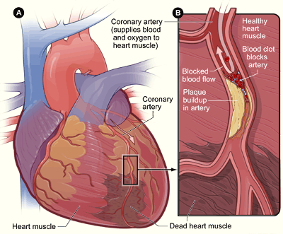 arteries of heart diagram. The coronary arteries